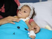 شاهد لحظة حقن ثانى طفلة بالعلاج الجينى بمركز الضمور العضلى بمعهد ناصر