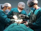 مستشفى سوهاج الجامعى يجرى عملية بناء ملامح وجه طفلة ضمن 130 حالة نادرة بالعالم