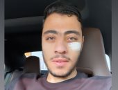 أكرم توفيق يكشف عن صورة جديدة تظهر إصابة وجهه خلال معسكر المنتخب