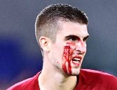 إصابة مروعة لـ مانشيني نجم روما في الوجه خلال مباراة أودينيزى.. صور 