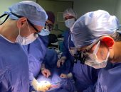 جامعة المنوفية تنجح فى إنقاذ حياة مريض تعرض لانفجار الشريان الأورطى