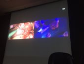 جامعة عين شمس تبدأ إجراء أول جراحة روبوتية باستخدام الإنسان الآلى