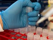 باحثون يسعون لابتكار لقاح ضد فيروس كورونا لمواجهة السلالات المختلفة