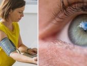 كيف يؤثر إهمال علاج ارتفاع ضغط الدم على صحة العين؟