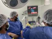 إجراء 20 عملية جراحية للقضاء على قوائم انتظار المرضى بمستشفى أبو حمص بالبحيرة 