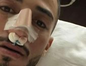 محمد عبد المنعم يجرى جراحة كسر الأنف بعد إصابته أمام السنغال