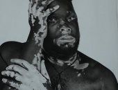 فنان أوغندى يواجه وصم مرضى البهاق بالرسم.. مايكل جاكسون سر إلهامه