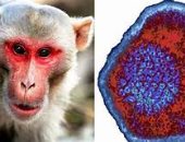 مركز السيطرة على الأمراض: جدري القرود يمكن أن يستمر في البيئات المنزلية