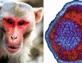 مراكز الوقاية من الأمراض الأمريكية CDC: جدرى القرود قد ينتقل عن طريق الهواء