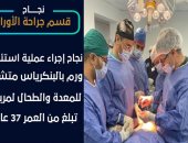 نجاح جديد بمستشفى الكرنك بالأقصر بإنقاذ مريضة من ورم بالبنكرياس.. التفاصيل