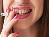 5 أضرار تصيب لثتك وأسنانك بسبب التدخين.. أبرزها سرطان الفم 