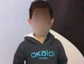 ننشر التقرير الطبي للطفل "ياسين" ضحية اصطدام سيارة مسرعة به في مدينة 6 أكتوبر 