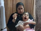 "ريتاج" طفلة من الإسكندرية ولدت بشلل وأصيبت بالضمور.. والصحة توجه بفحص حالتها