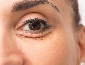 وصفات طبيعية لعلاج تجاعيد تحت العين.. للحصول على بشرة ناعمة وشابة