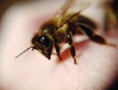 7 علاجات منزلية فعالة لعلاج لسعة النحل والتخلص من الألم
