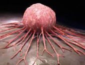 دراسة أمريكية تنجح فى اكتشاف جزىء يمكنه إيقاف نمو سرطان البنكرياس