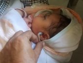 توقيع الكشف الطبي على 11 ألف طفل من حديثي الولادة بالمنيا خلال يونيو الماضى
