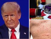 باختصار.. أهم الأخبار العالمية والعربية حتى منتصف الليل.. الصين تسجل أول إصابة بجدرى القرود.. جنوب إفريقيا تطالب العائلة الملكية البريطانية بإعادة ماسة النجمة الكبرى.. شاب يذبح والدته ليلة زفاف شقيقته فى اليمن