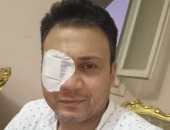 عمرو رمزى يجرى عملية جراحية في العين