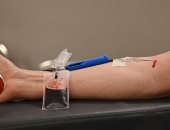 هل يجب أن تصوم قبل إجراء فحص الدم؟