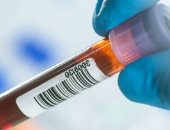 بواسطة الذكاء الاصطناعي.. اختبار دم يمكنه اكتشاف 12 نوعًا من السرطان