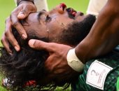 كأس العالم 2022.. تقارير: إصابة ياسر الشهرانى بكسر فى الفك وأضرار بالأسنان