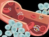 هل يمكن محاربة السرطان بالبكتيريا المغناطيسية؟