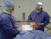فريق جراحي بقها التخصصي يستأصل ورم من ظهر مريضة بالعقد السادس.. صور