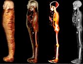 الأشعة المقطعية تكشف أسرار مومياء الصبى الذهبى ببدروم المتحف المصرى بالتحرير