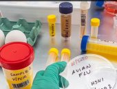علماء: سلالة أنفلونزا الطيور H5N1 يمكن أن تكون أسوأ 100 مرة من كورونا