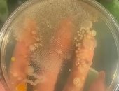ديلى ميل تكشف عن أكبر مستعمرة للبكتيريا فى جسم الإنسان.. وأطباء: تبلغ 20 مليارا