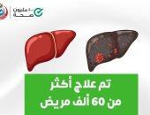 الصحة: علاج أكثر من 60 ألف مريض بسرطان الكبد بالمجان