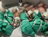 CNN: أطباء مستشفى الشفاء يضعون الأطفال المبتسرين فى ورق "فويل"