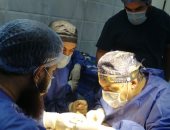 فريق طبى بمستشفى الشرقية يجرى 7 عمليات وصلات شريانية وقسطرة
