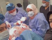 جامعة أسوان تشارك بورشتى عمل لجراحات أورام الثدى بليبيا