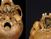 اكتشاف سدادة لعلاج فم عمرها 300 عام مصنوعة من الذهب والنحاس في بولندا