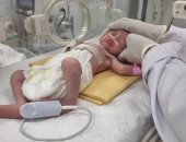 كيف أنقذ أطباء غزة صابرين بعد ولادة قيصرية لأمها الشهيدة؟.. فيديو وصور