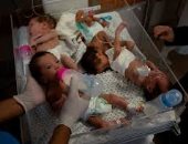 إسبانيا تقترح تنسيق جلب وعلاج الأطفال المرضى من غزة للاتحاد الأوروبى