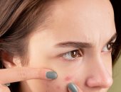 8 أشياء ممنوعة على صاحبات البشرة الدهنية.. منها غسيل الوجه بكثرة  