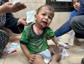 مسئولون فلسطينيون بغزة: 3500 طفل معرضون للموت بسبب سوء التغذية وانعدام التطعيمات