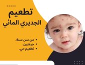 فاكسيرا: توفير تطعيم الجديرى المائى بفروع المصل واللقاح
