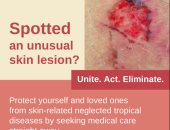 الصحة العالمية: 75 مليون بشرق البحر المتوسط يحتاجون لتدخلات للأمراض المعدية