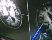 قدرة الدماغ على التحمل تصل لذروتها بعد ساعة من  الإجهاد.. دراسة توضح