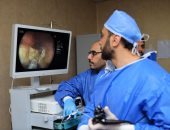 تفاصيل تقنية المناظير الجديدة لعلاج أمراض الجهاز الهضمى بمستشفى كفر الشيخ الجامعى