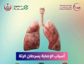 وزارة الصحة تكشف عن أسباب الإصابة بسرطان الرئة.. تفاصيل