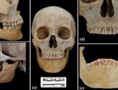 اكتشاف مقبرة صينية عمرها 2.200 عام يظهر امرأة بأسنان مغطاة بمعدن سام