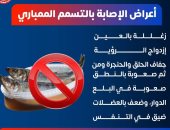 وزارة الصحة تكشف أعراض التسمم الممبارى نتيجة تناول الأسماك المملحة