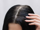 علاجات منزلية فعالة لانسداد بصيلات الشعر