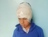 طالب إعدادى يكشف تفاصيل اعتداء زميليه عليه بكتر فى أوسيم.. صور