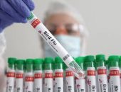 الصحة العالمية: الوضع الوبائى لإنفلونزا الطيور فى العالم لايزال منخفضا